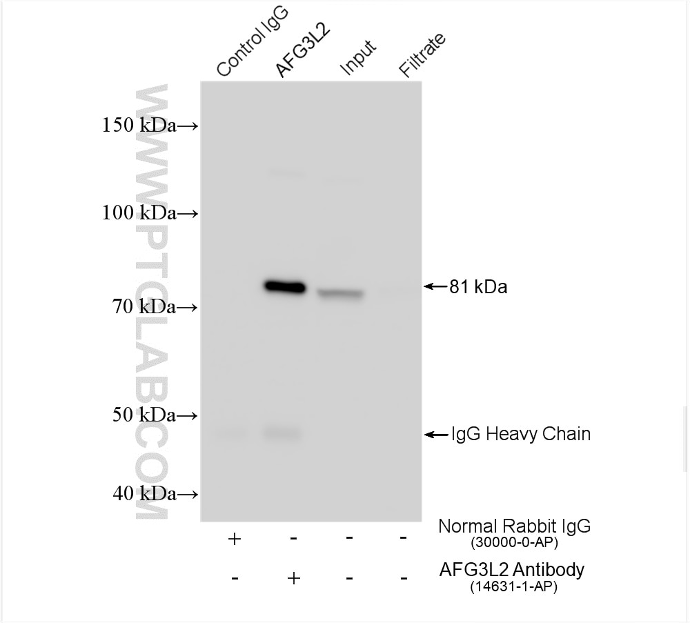 Immunoprecipitation (IP) experiment of HeLa cells using AFG3L2 Polyclonal antibody (14631-1-AP)