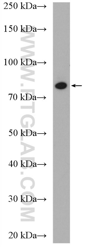 Western Blot (WB) analysis of mouse kidney tissue using AFG3L2 Polyclonal antibody (14631-1-AP)