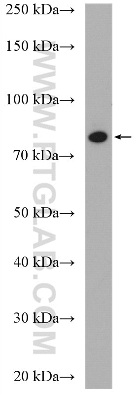 WB analysis of mouse kidney using 14631-1-AP