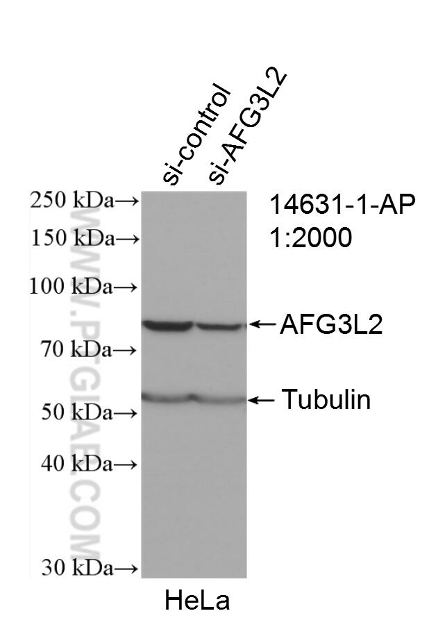 Western Blot (WB) analysis of HeLa cells using AFG3L2 Polyclonal antibody (14631-1-AP)