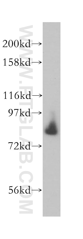 Western Blot (WB) analysis of mouse skeletal muscle tissue using AFG3L2 Polyclonal antibody (14631-1-AP)