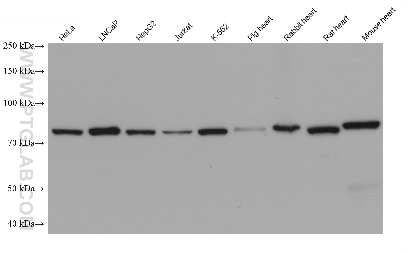 Western Blot (WB) analysis of various lysates using AFG3L2 Monoclonal antibody (68517-1-Ig)