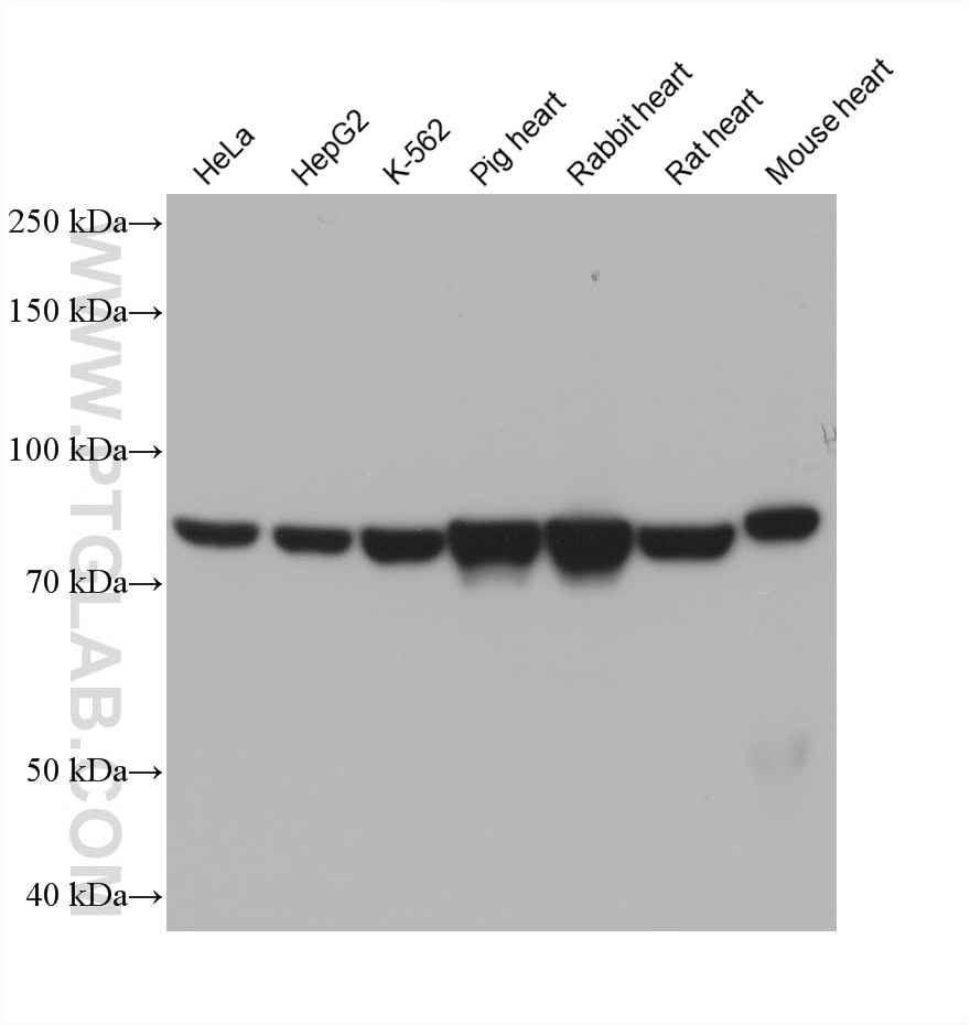 Western Blot (WB) analysis of various lysates using AFG3L2 Monoclonal antibody (68517-1-Ig)