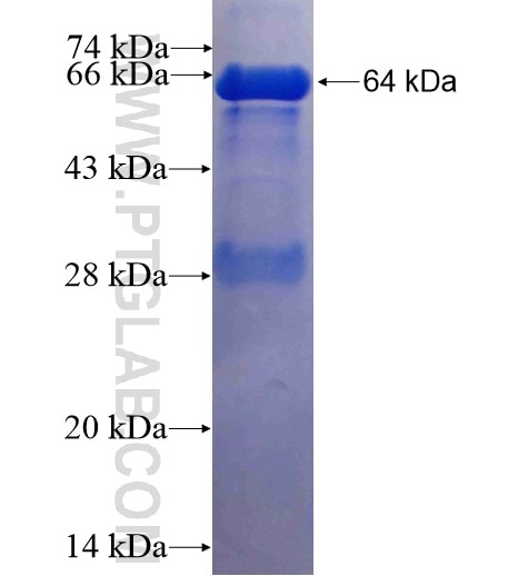 AFG3L2 fusion protein Ag6209 SDS-PAGE