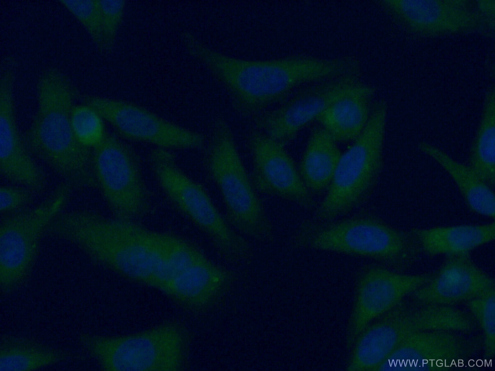 Immunofluorescence (IF) / fluorescent staining of HepG2 cells using AFM Polyclonal antibody (19494-1-AP)