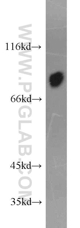 Western Blot (WB) analysis of human plasma using AFM Polyclonal antibody (19494-1-AP)