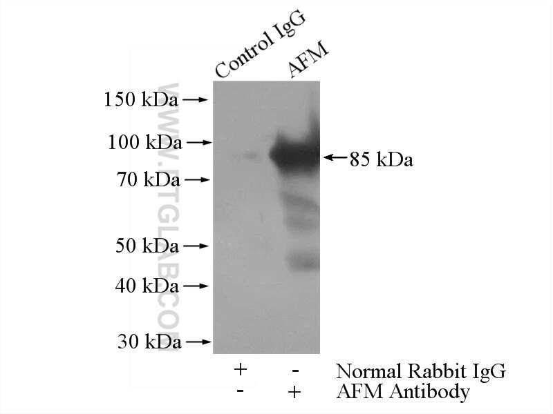 Immunoprecipitation (IP) experiment of human plasma using AFM Polyclonal antibody (25280-1-AP)