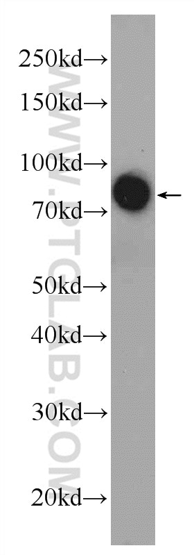 Western Blot (WB) analysis of human blood using AFM Polyclonal antibody (25280-1-AP)