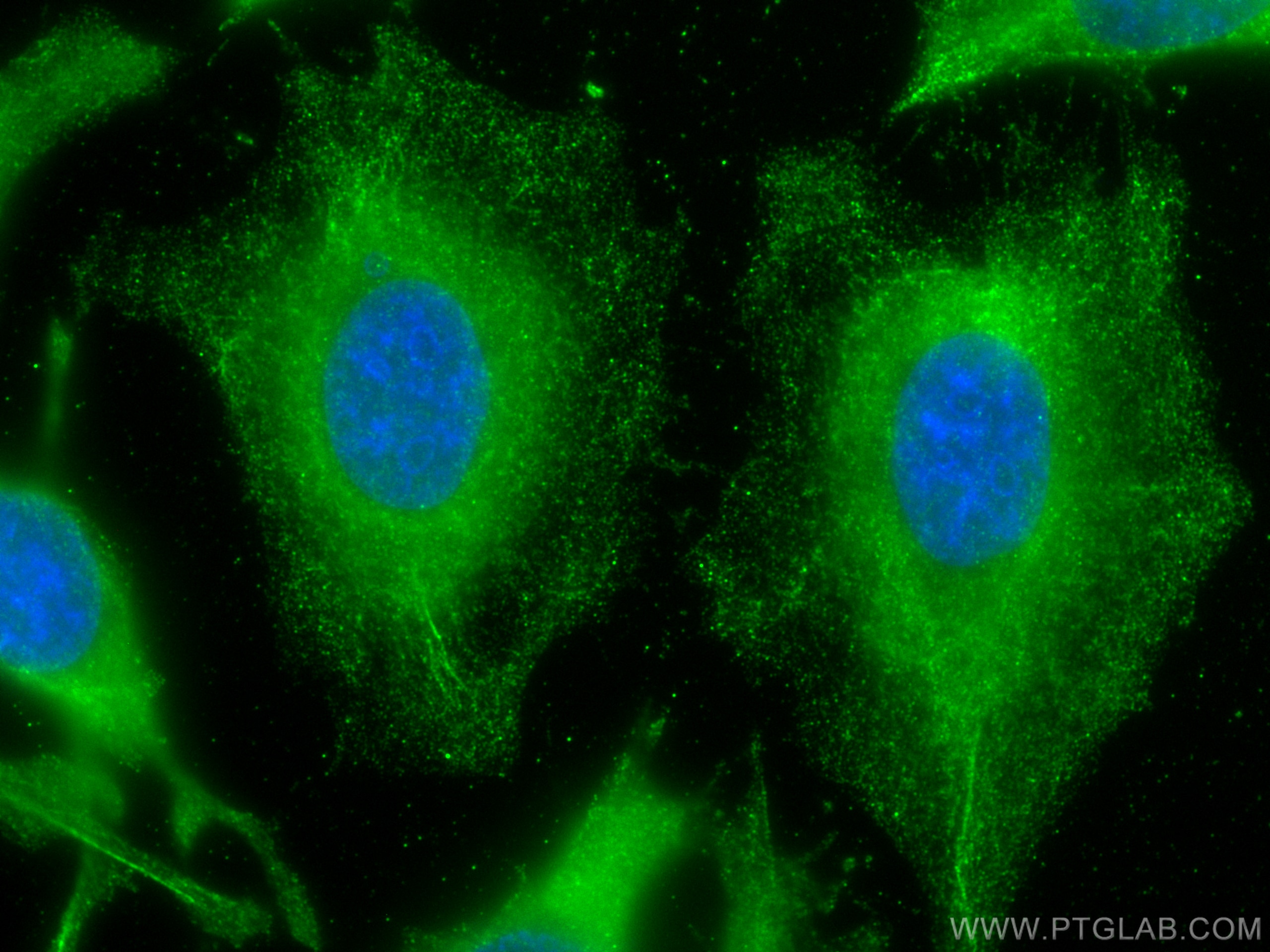 Immunofluorescence (IF) / fluorescent staining of HeLa cells using AFM Monoclonal antibody (66113-1-Ig)