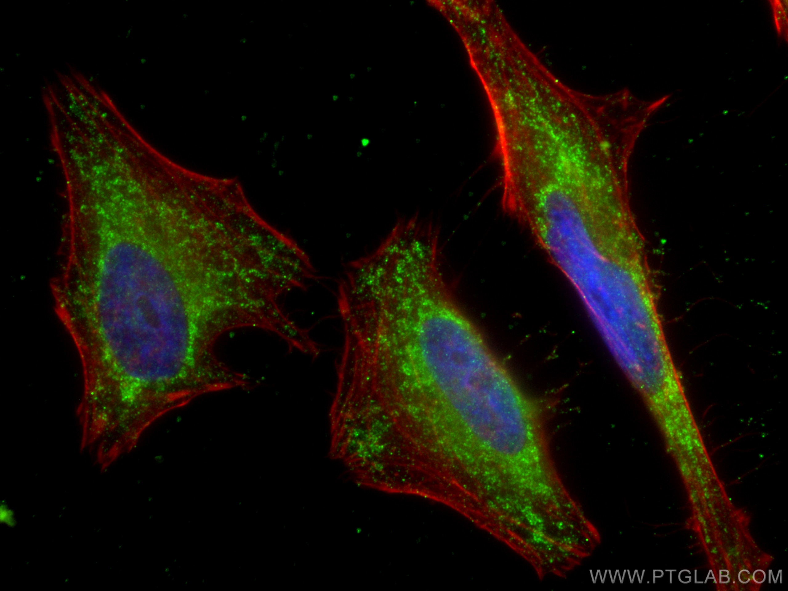 Immunofluorescence (IF) / fluorescent staining of HeLa cells using AFM Monoclonal antibody (66113-1-Ig)