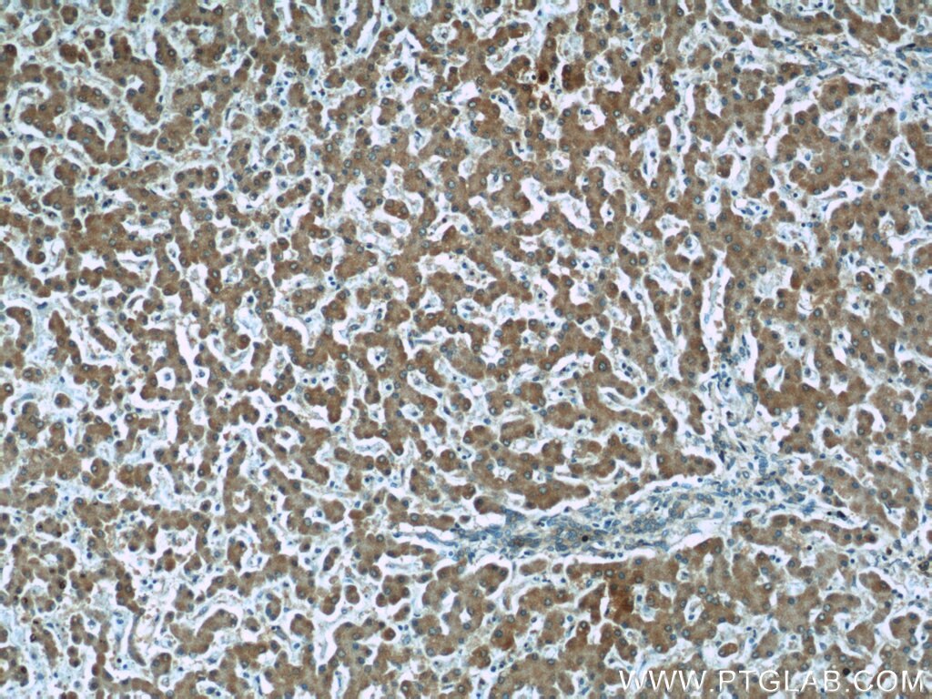 Immunohistochemistry (IHC) staining of human liver tissue using AFM Monoclonal antibody (66113-1-Ig)