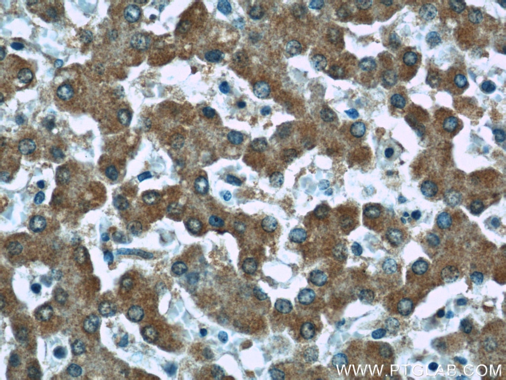 Immunohistochemistry (IHC) staining of human liver tissue using AFM Monoclonal antibody (66113-1-Ig)