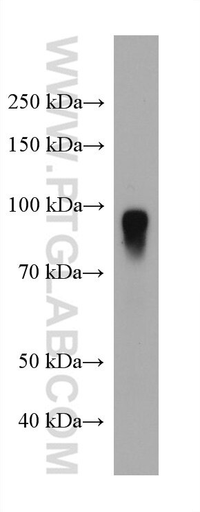 Western Blot (WB) analysis of human plasma using AFM Monoclonal antibody (66113-1-Ig)