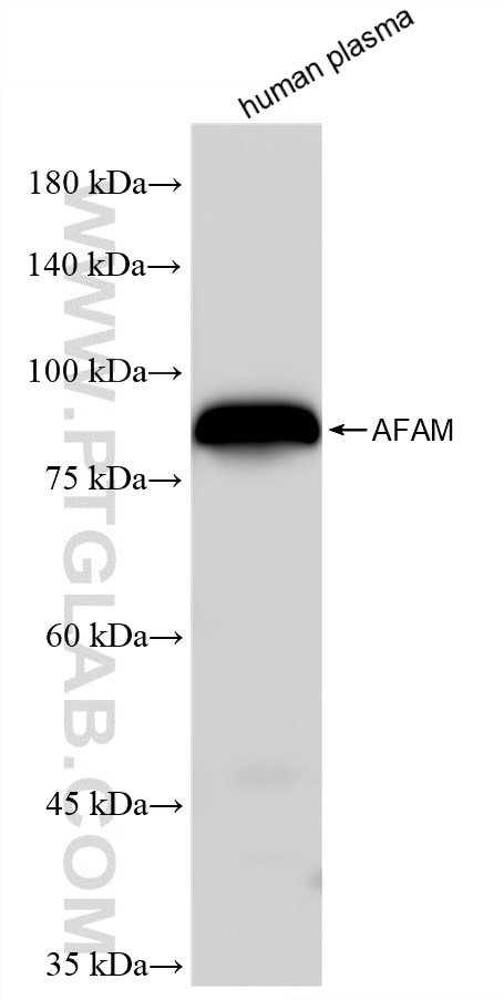 Western Blot (WB) analysis of human plasma using AFM Recombinant monoclonal antibody (88507-1-RR)