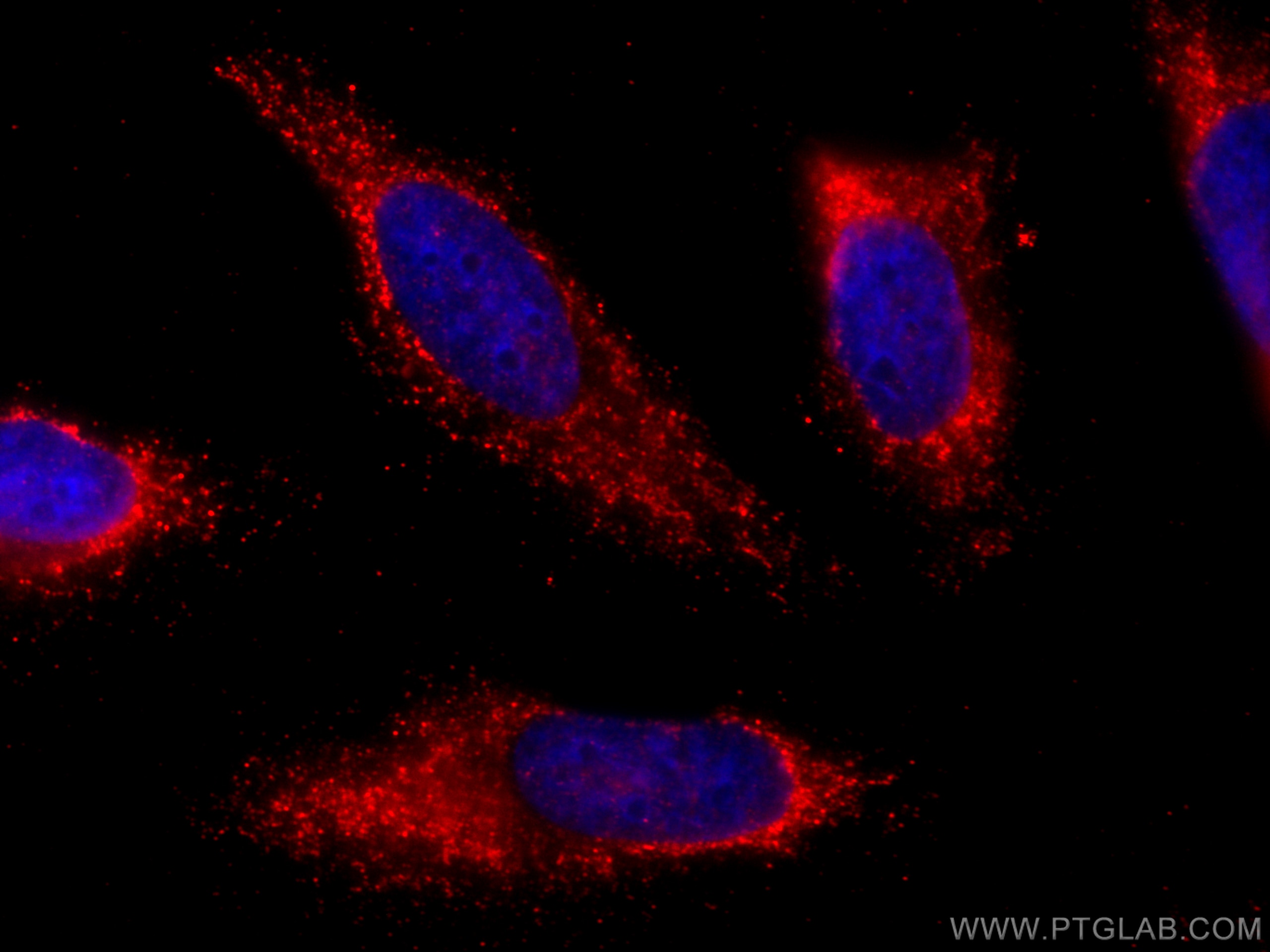 Immunofluorescence (IF) / fluorescent staining of HeLa cells using CoraLite®594-conjugated AFM Monoclonal antibody (CL594-66113)