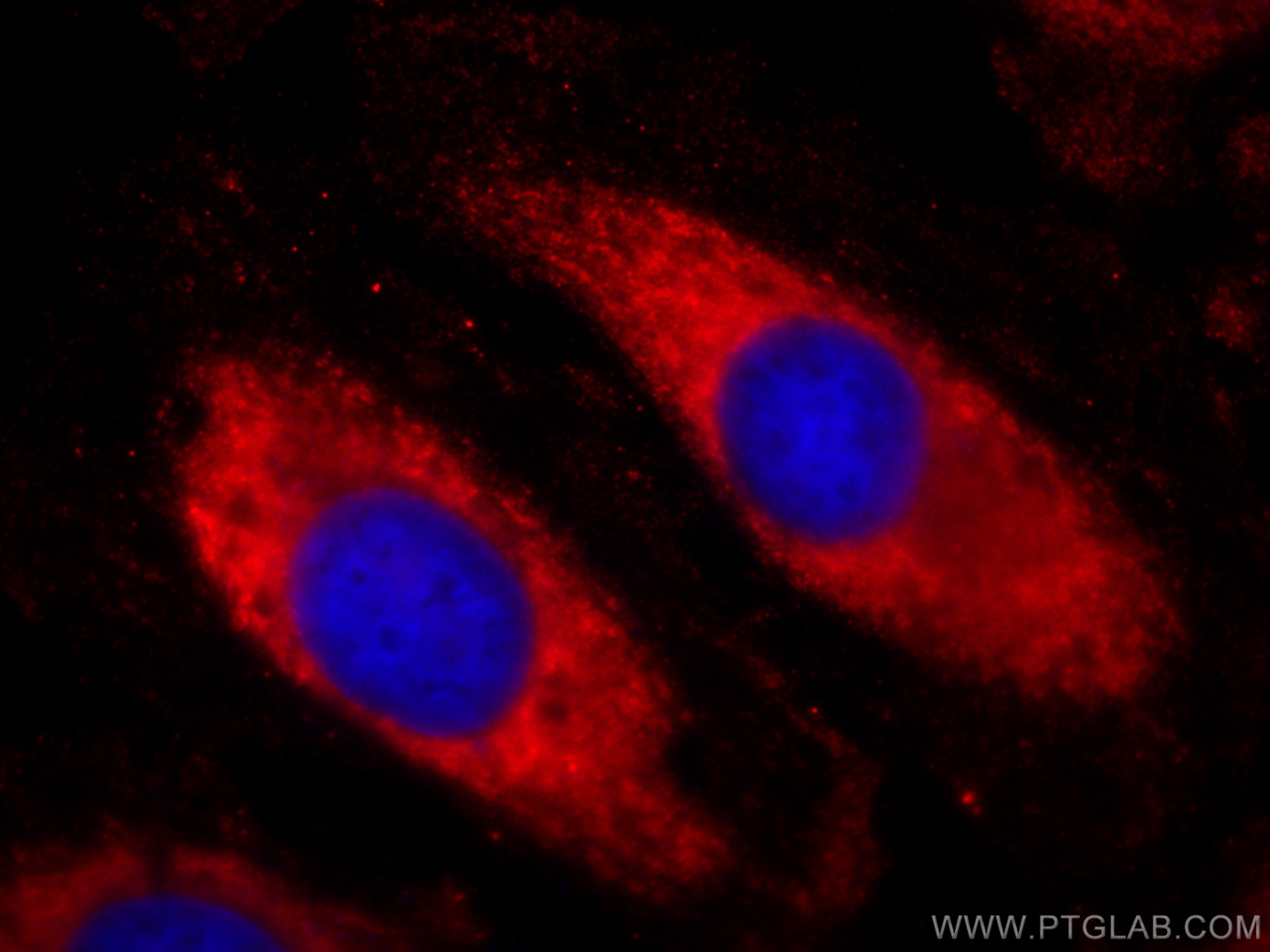 Immunofluorescence (IF) / fluorescent staining of HeLa cells using CoraLite®594-conjugated AFM Monoclonal antibody (CL594-66113)