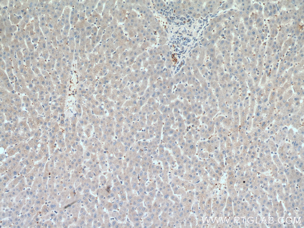 Immunohistochemistry (IHC) staining of human liver tissue using AFMID Polyclonal antibody (19522-1-AP)