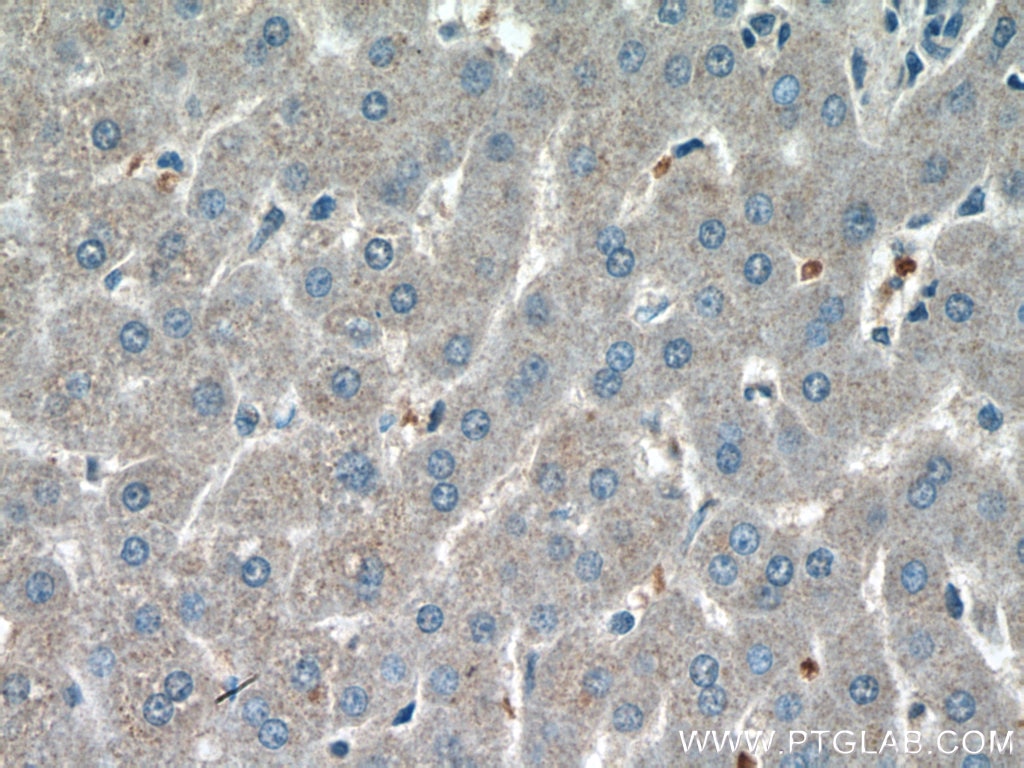 Immunohistochemistry (IHC) staining of human liver tissue using AFMID Polyclonal antibody (19522-1-AP)