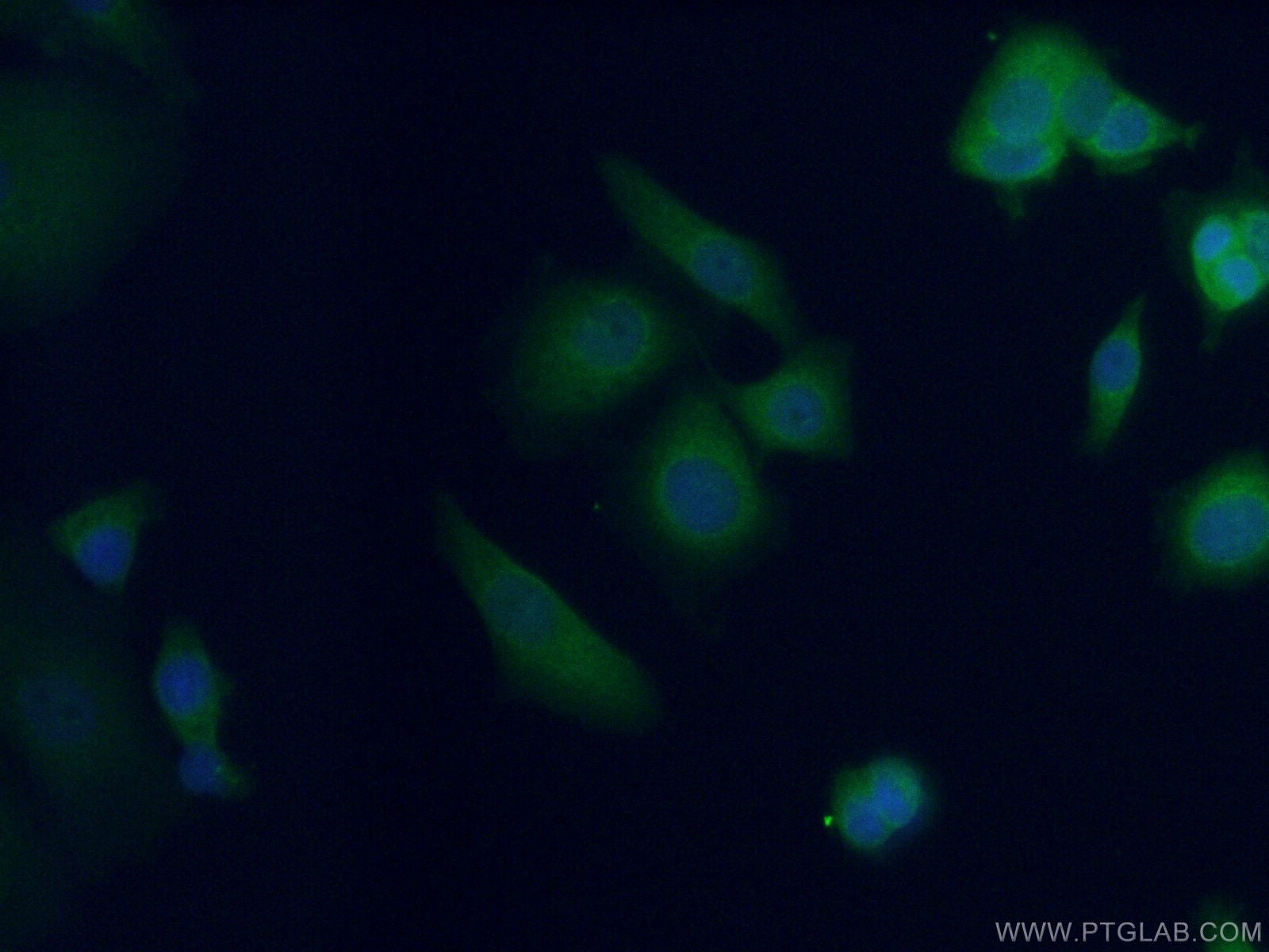Immunofluorescence (IF) / fluorescent staining of MCF-7 cells using AFP Polyclonal antibody (14550-1-AP)