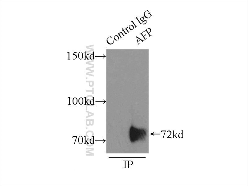 Immunoprecipitation (IP) experiment of HepG2 cells using AFP Polyclonal antibody (14550-1-AP)