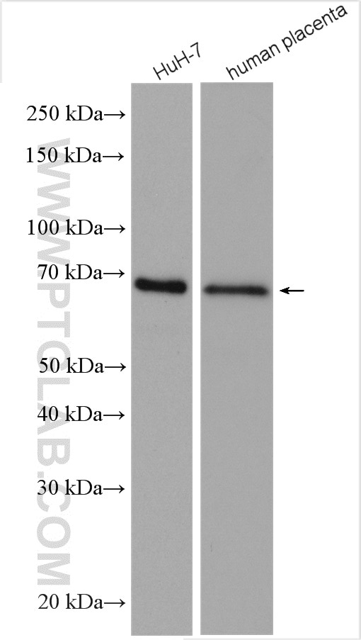 Western Blot (WB) analysis of various lysates using AFP Polyclonal antibody (14550-1-AP)