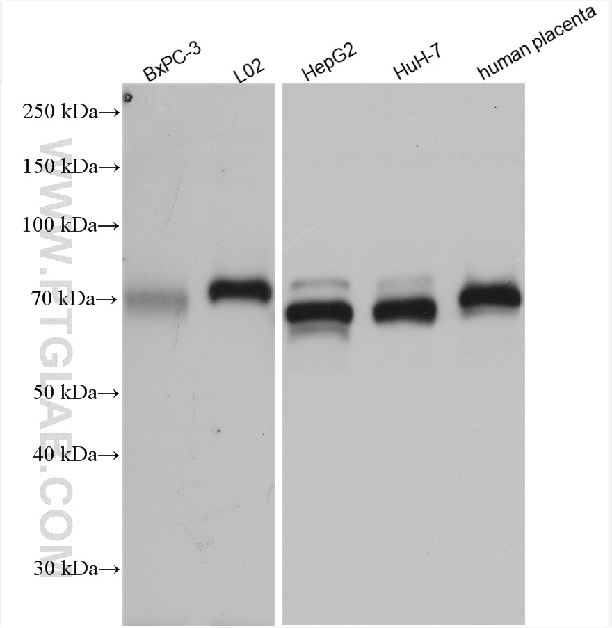 WB analysis of BxPC-3 using 14550-1-AP