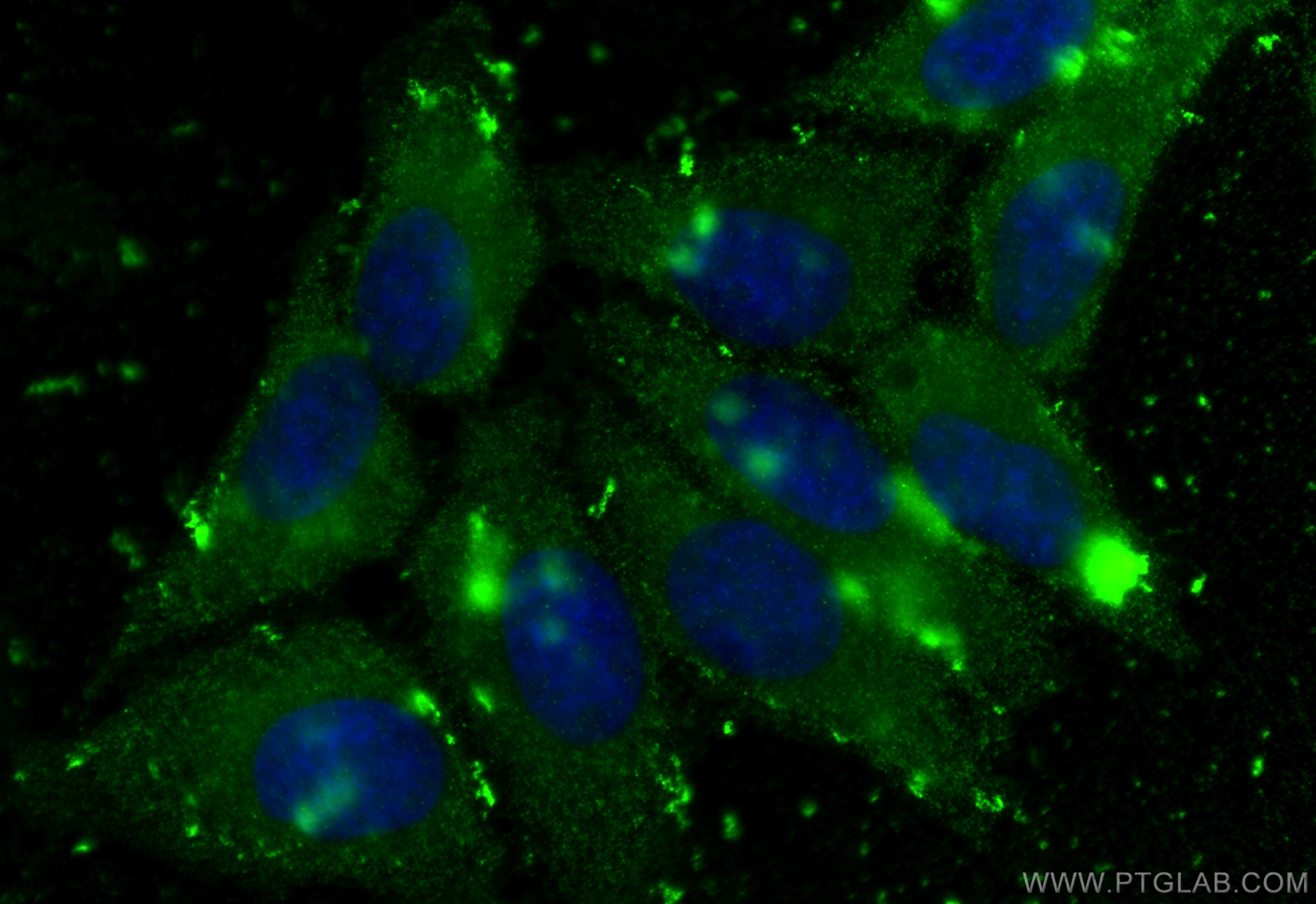 Immunofluorescence (IF) / fluorescent staining of HepG2 cells using AFP Polyclonal antibody (32214-1-AP)