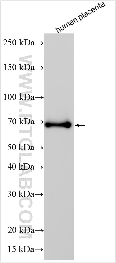 Western Blot (WB) analysis of various lysates using AFP Polyclonal antibody (32214-1-AP)