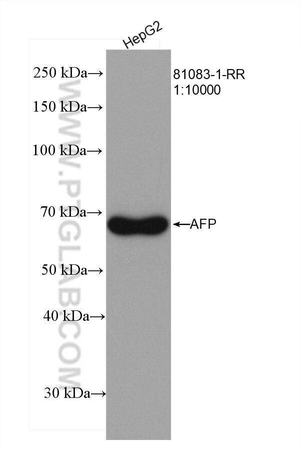 Western Blot (WB) analysis of various lysates using AFP Recombinant antibody (81083-1-RR)