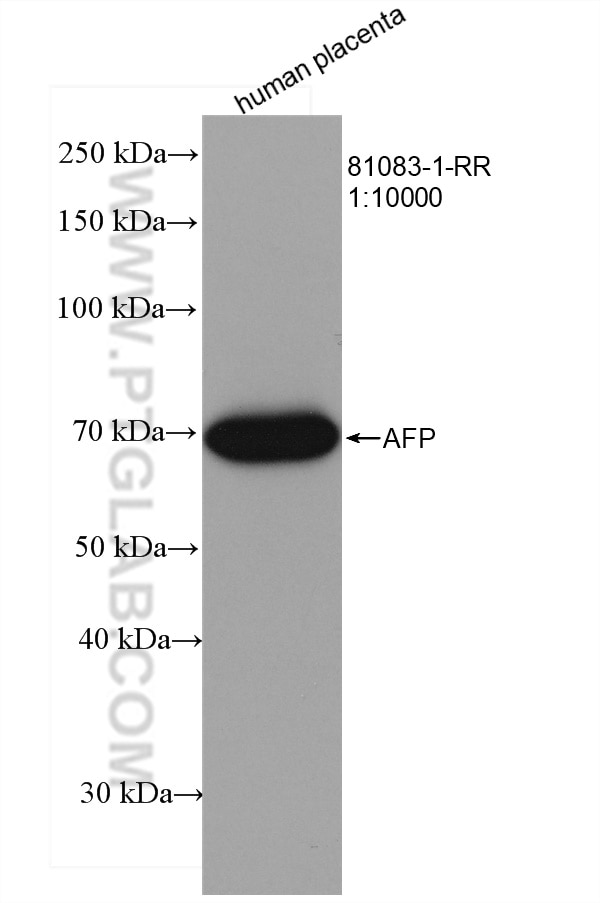 Western Blot (WB) analysis of various lysates using AFP Recombinant antibody (81083-1-RR)