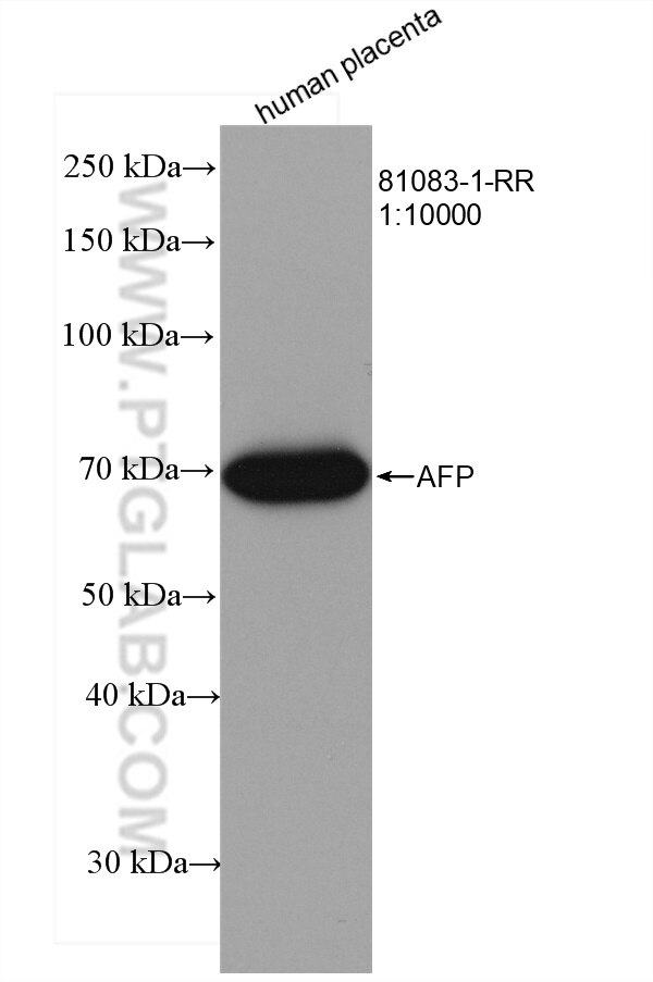 WB analysis using 81083-1-RR