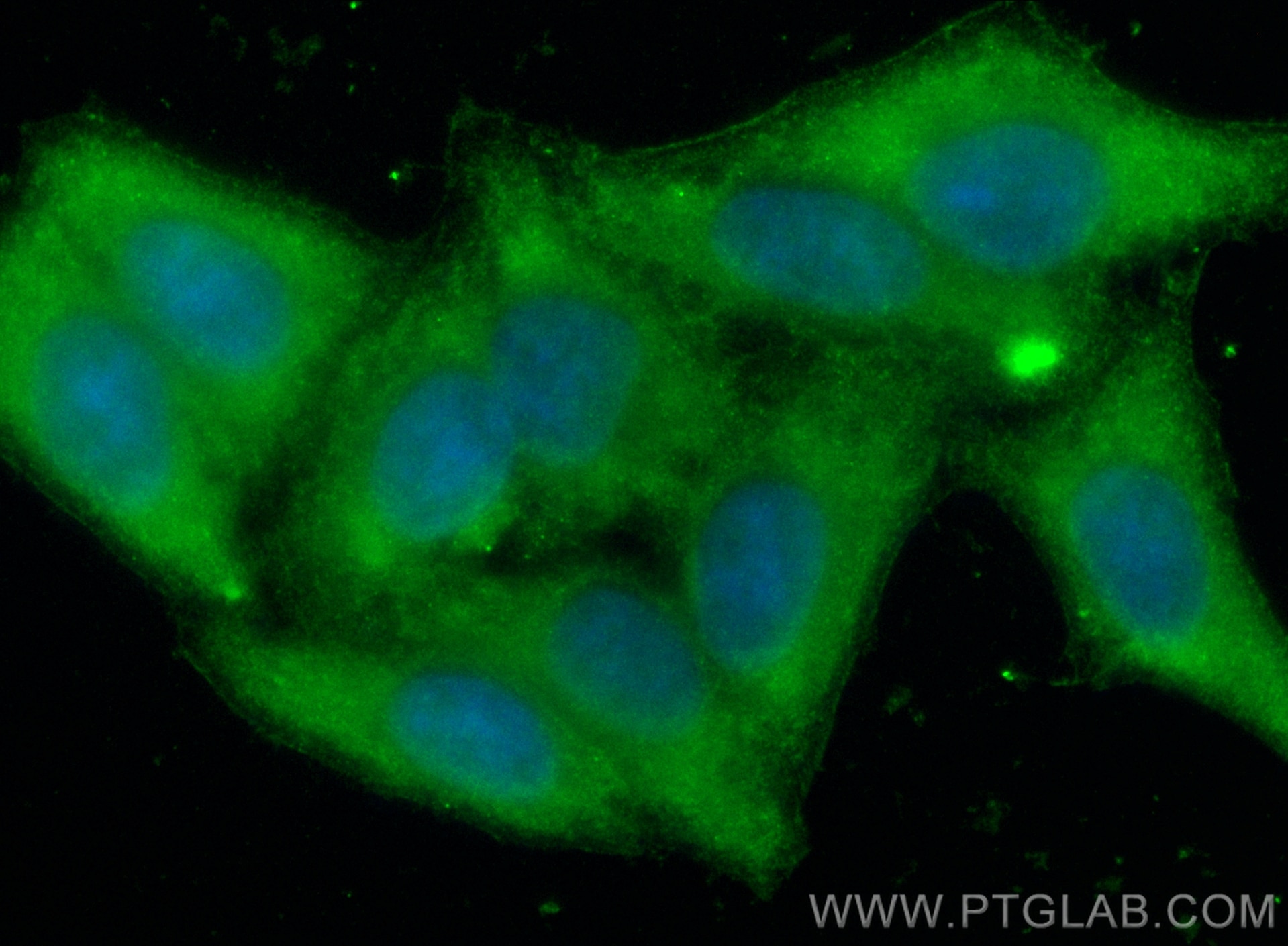 Immunofluorescence (IF) / fluorescent staining of HepG2 cells using CoraLite® Plus 488-conjugated AFP Recombinant anti (CL488-82982-5)