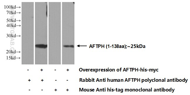 Western Blot (WB) analysis of Transfected HEK-293 cells using AFTPH Polyclonal antibody (11785-1-AP)