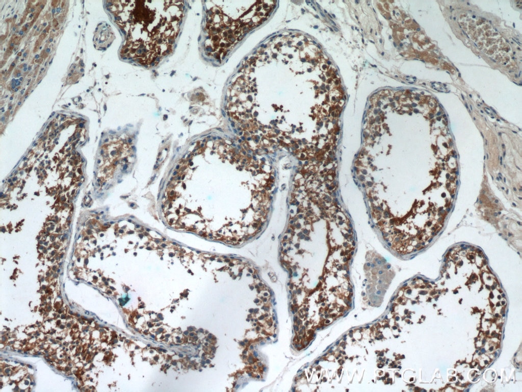 Immunohistochemistry (IHC) staining of human testis tissue using AGA Polyclonal antibody (17299-1-AP)