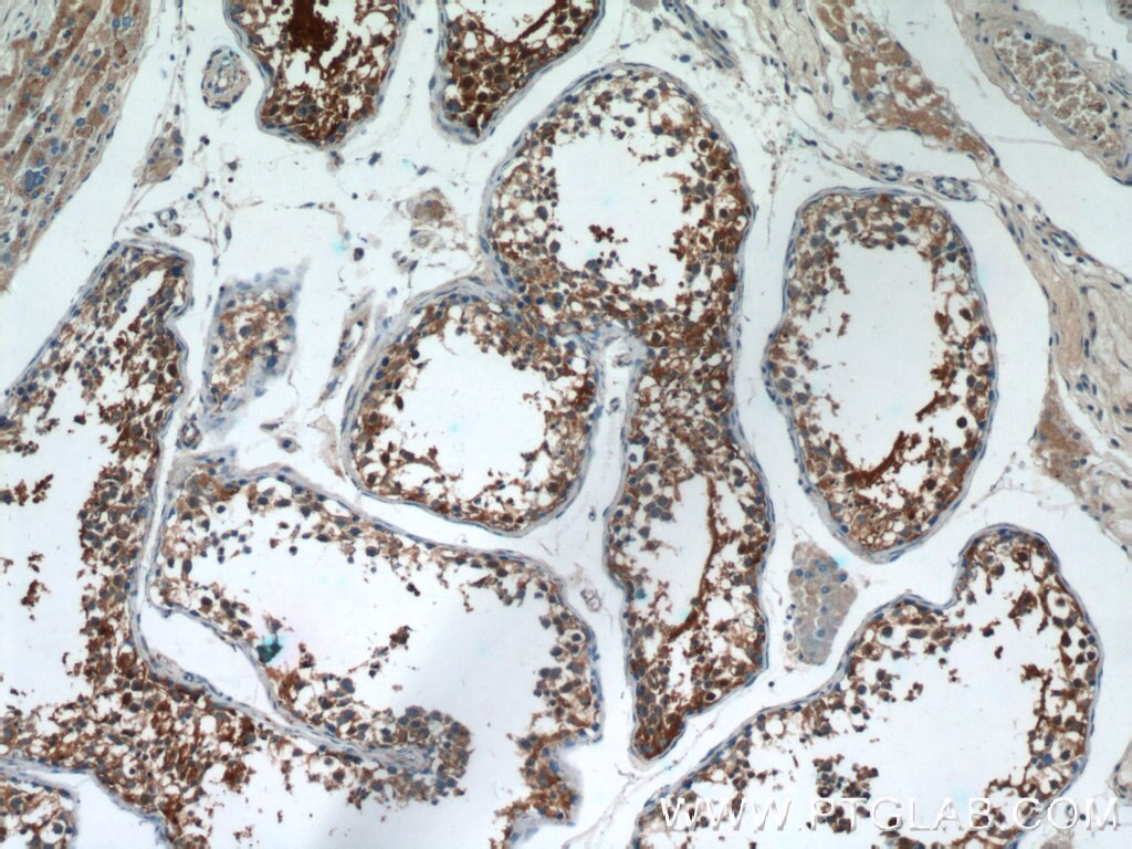 IHC staining of human testis using 17299-1-AP