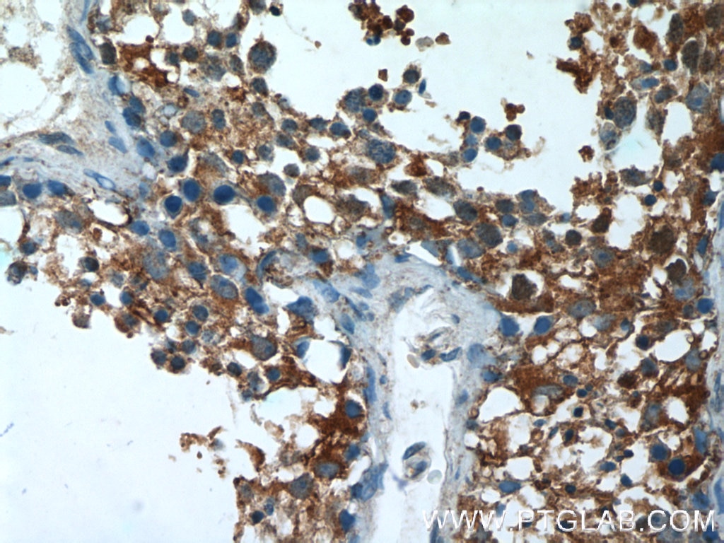 Immunohistochemistry (IHC) staining of human testis tissue using AGA Polyclonal antibody (17299-1-AP)