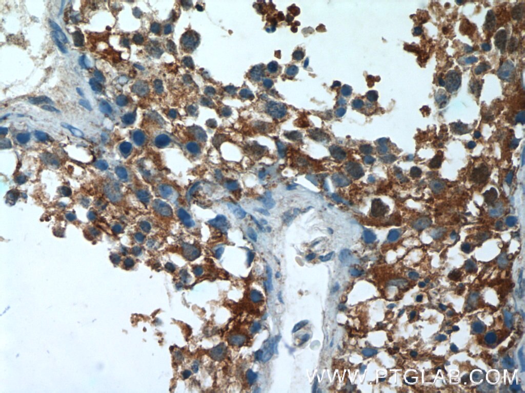 IHC staining of human testis using 17299-1-AP