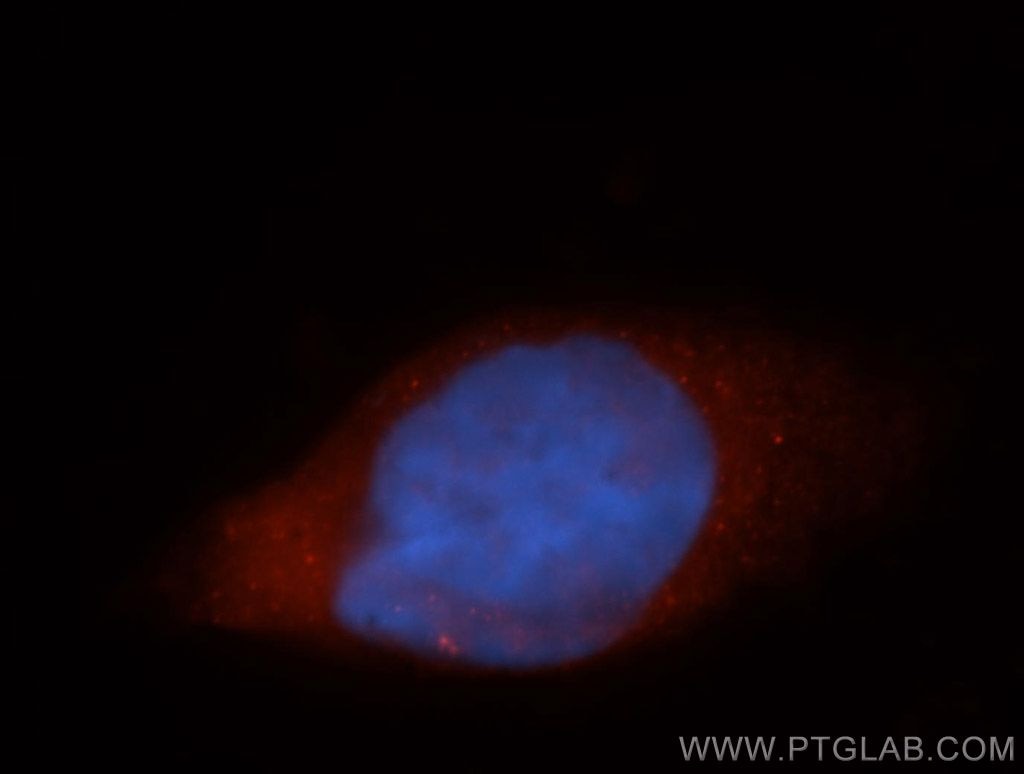Immunofluorescence (IF) / fluorescent staining of HeLa cells using AGAP2 Polyclonal antibody (14690-1-AP)