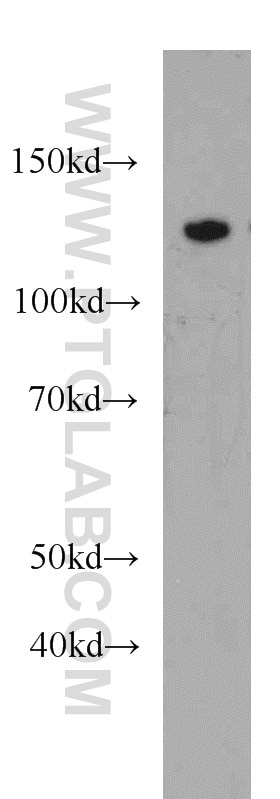 Western Blot (WB) analysis of rat brain tissue using AGAP2 Polyclonal antibody (14690-1-AP)