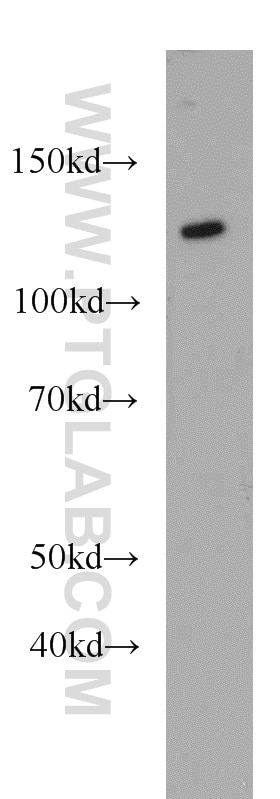 Western Blot (WB) analysis of rat brain tissue using AGAP2 Polyclonal antibody (14690-1-AP)