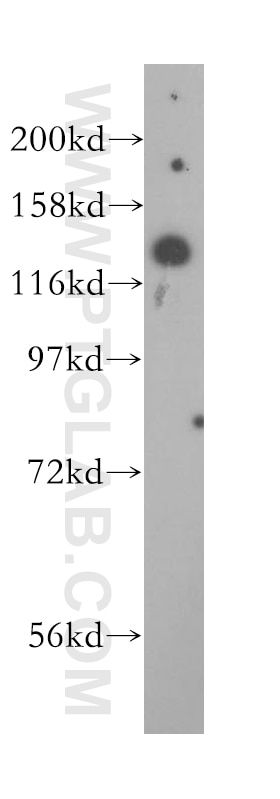 Western Blot (WB) analysis of human brain tissue using AGAP2 Polyclonal antibody (14690-1-AP)