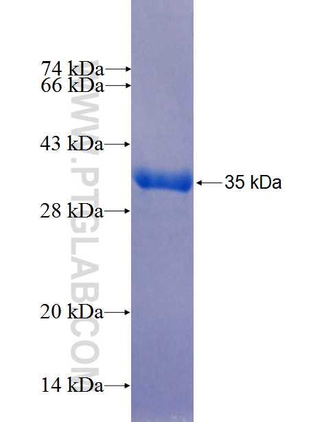 AGAP3 fusion protein Ag26662 SDS-PAGE