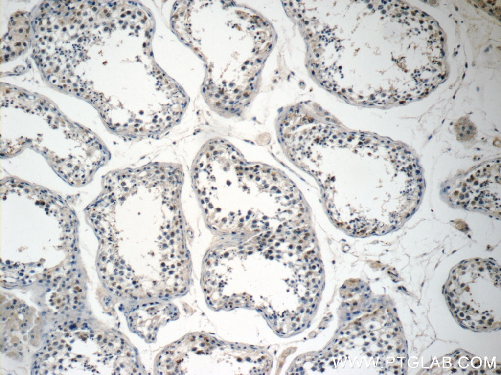 Immunohistochemistry (IHC) staining of human testis tissue using AGBL3 Polyclonal antibody (16990-1-AP)