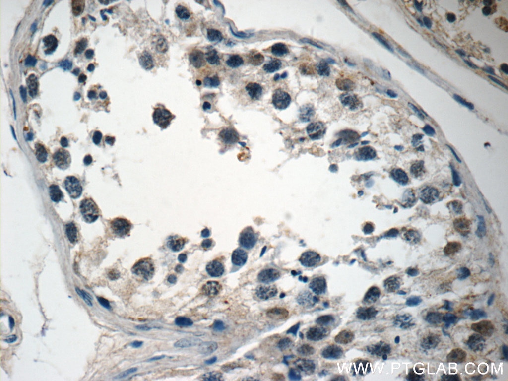 Immunohistochemistry (IHC) staining of human testis tissue using AGBL3 Polyclonal antibody (16990-1-AP)