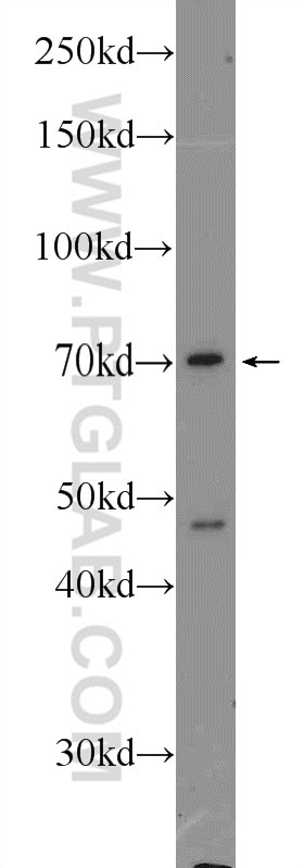 Western Blot (WB) analysis of L02 cells using AGBL3 Polyclonal antibody (16990-1-AP)