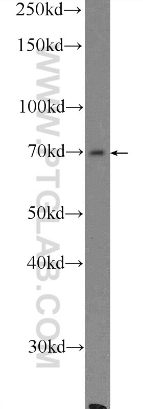Western Blot (WB) analysis of mouse liver tissue using AGBL3 Polyclonal antibody (16990-1-AP)