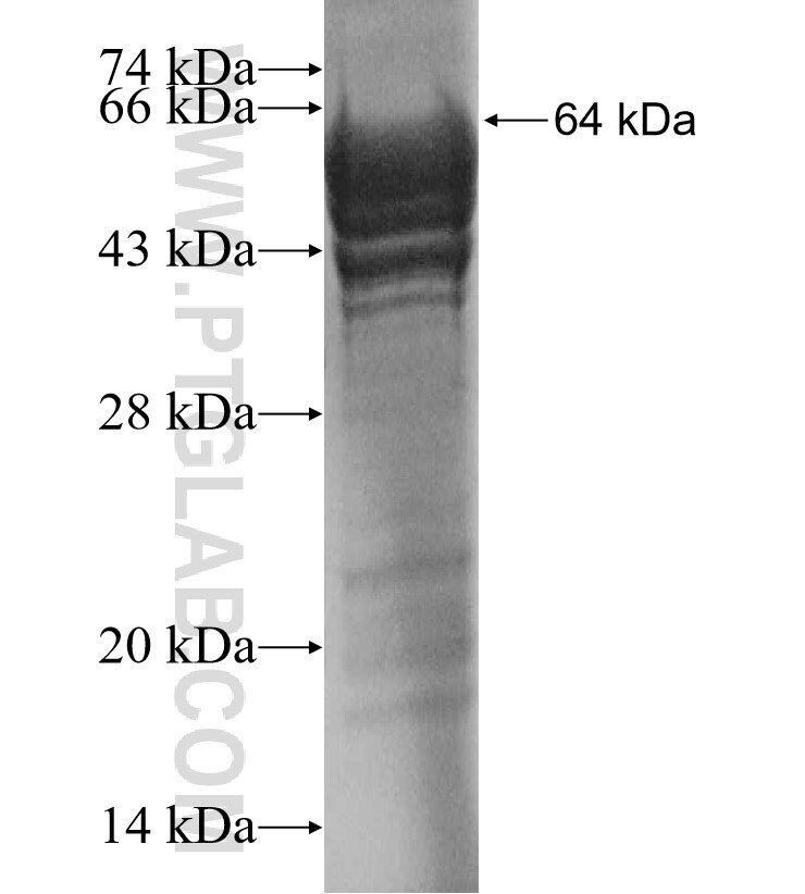 AGBL3 fusion protein Ag10592 SDS-PAGE