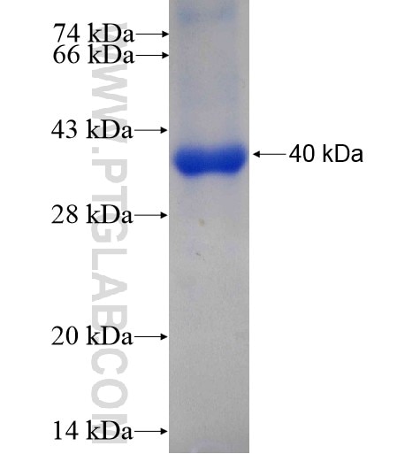 AGBL3 fusion protein Ag11013 SDS-PAGE
