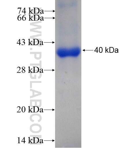 AGBL3 fusion protein Ag11013 SDS-PAGE