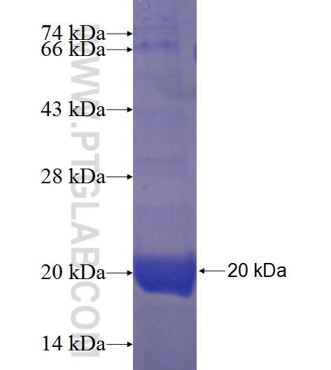 AGBL4 fusion protein Ag22784 SDS-PAGE